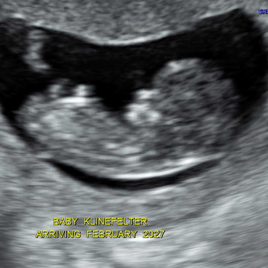 Photo shared by McKenzie for their Babylist baby registry.