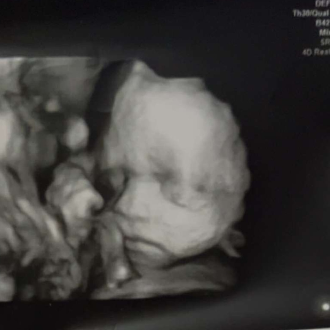 Photo shared by Haylie for their Babylist baby registry.