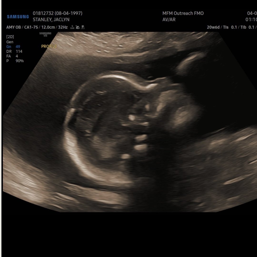 Photo shared by Jaclyn for their Babylist baby registry.