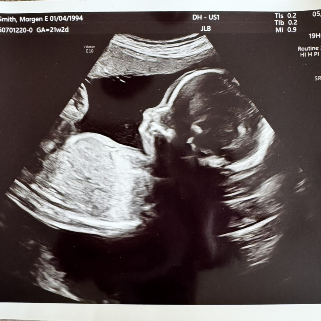 Photo shared by Morgen for their Babylist baby registry.