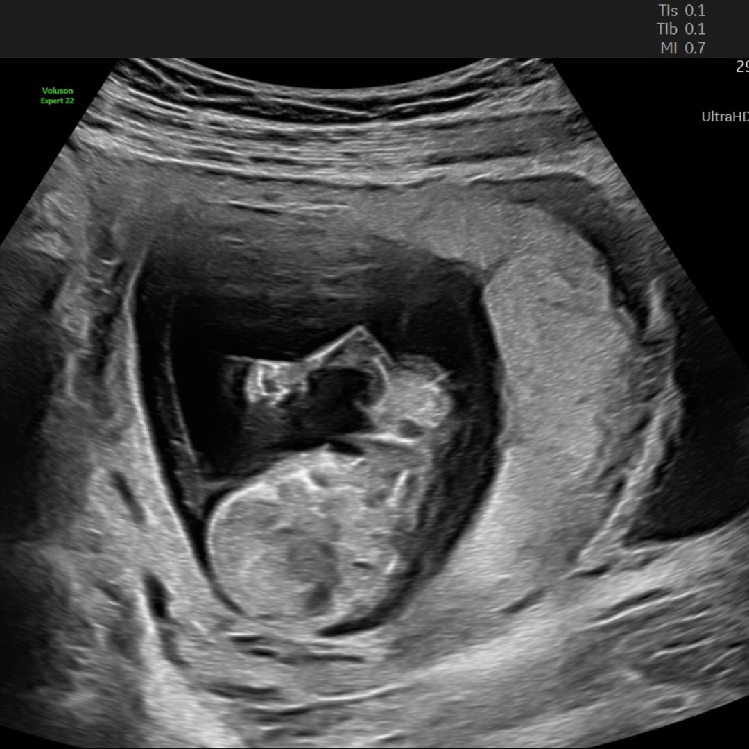 Photo shared by Carmen for their Babylist baby registry.