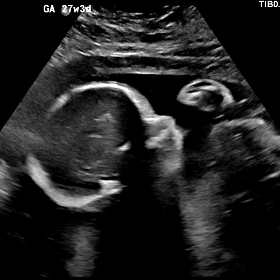 Photo shared by Bridget for their Babylist baby registry.