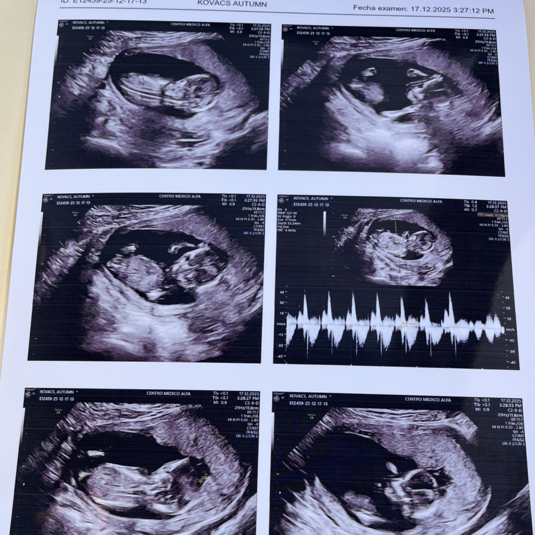 Photo shared by Autumn for their Babylist baby registry.