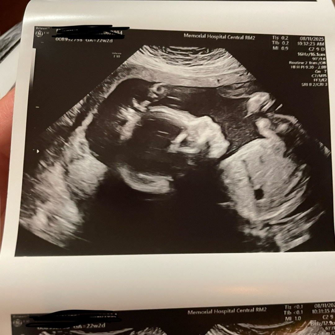 Photo shared by Katie for their Babylist baby registry.