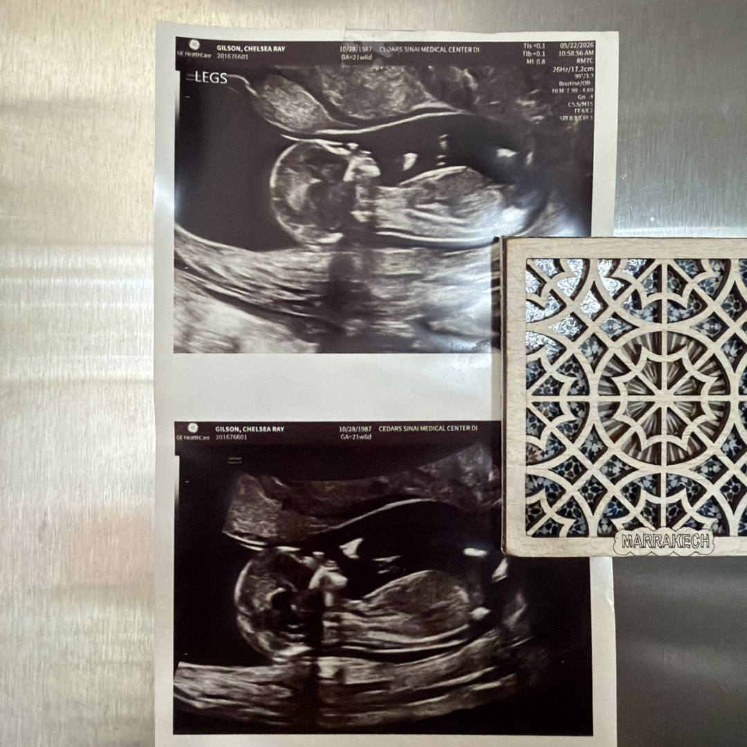 Photo shared by Chelsea for their Babylist baby registry.