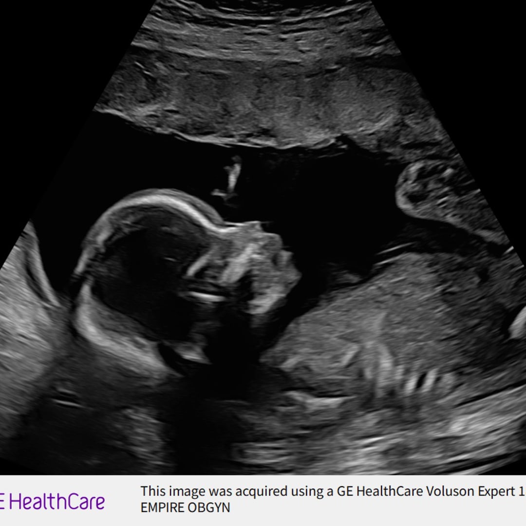 Photo shared by Maria for their Babylist baby registry.