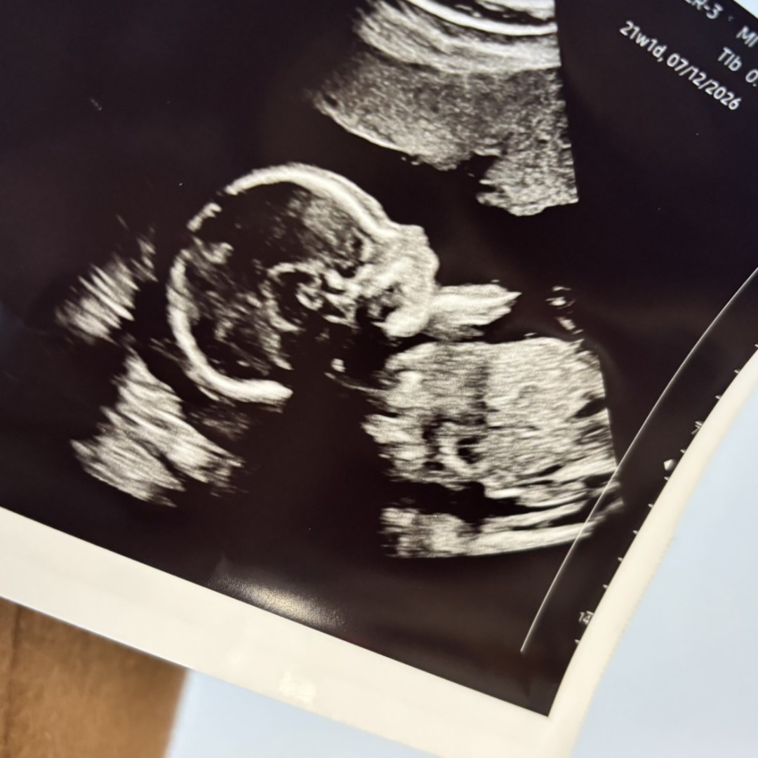 Photo shared by Ava for their Babylist baby registry.