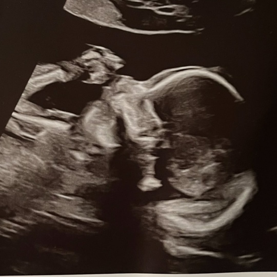 Photo shared by Elis for their Babylist baby registry.
