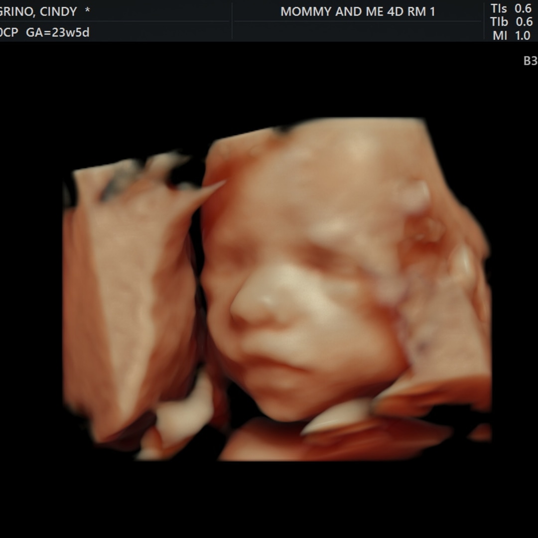 Photo shared by Cindy for their Babylist baby registry.