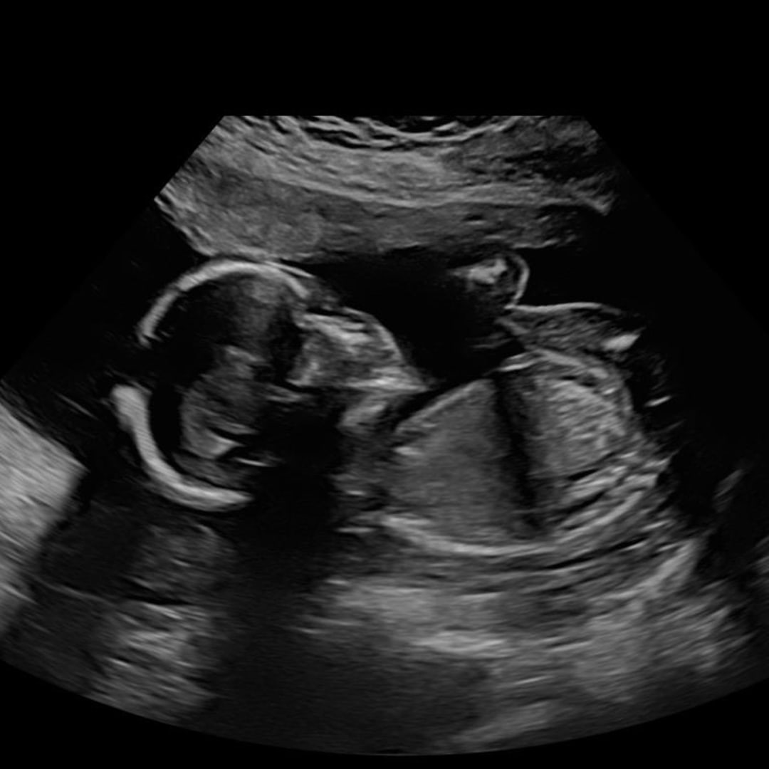 Photo shared by Annika for their Babylist baby registry.