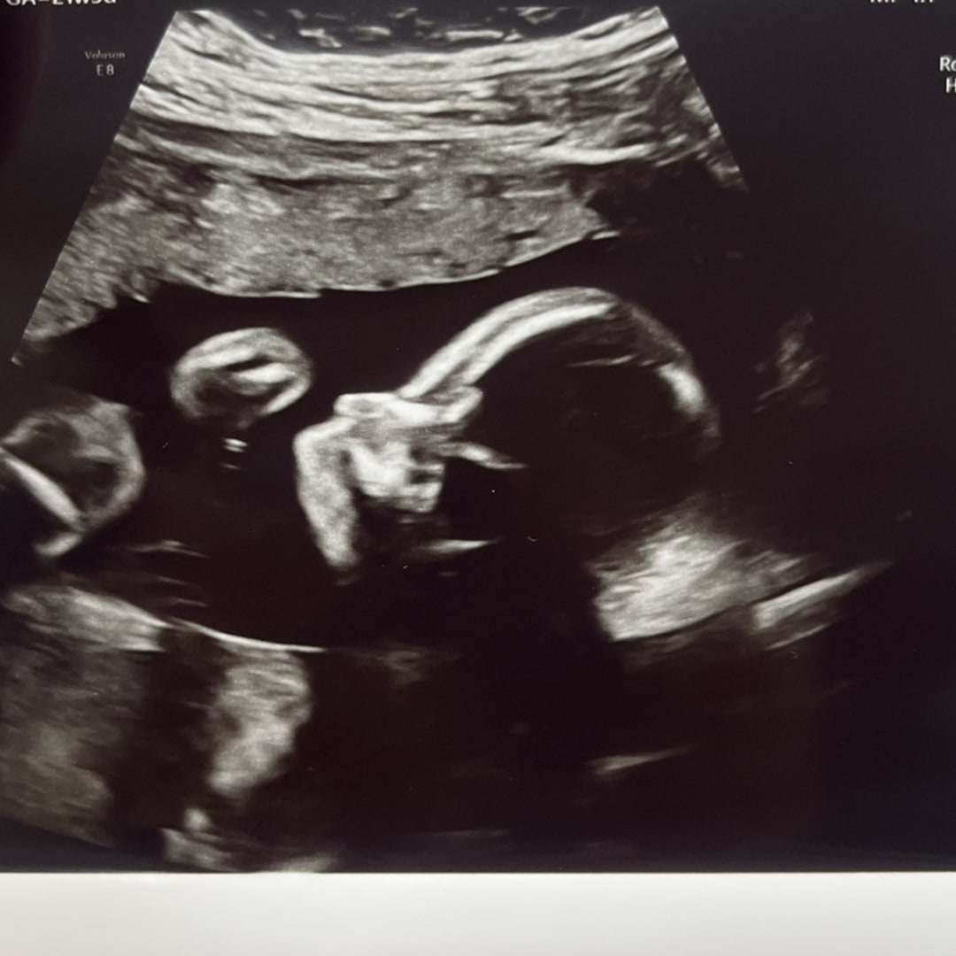 Photo shared by Elizabeth for their Babylist baby registry.