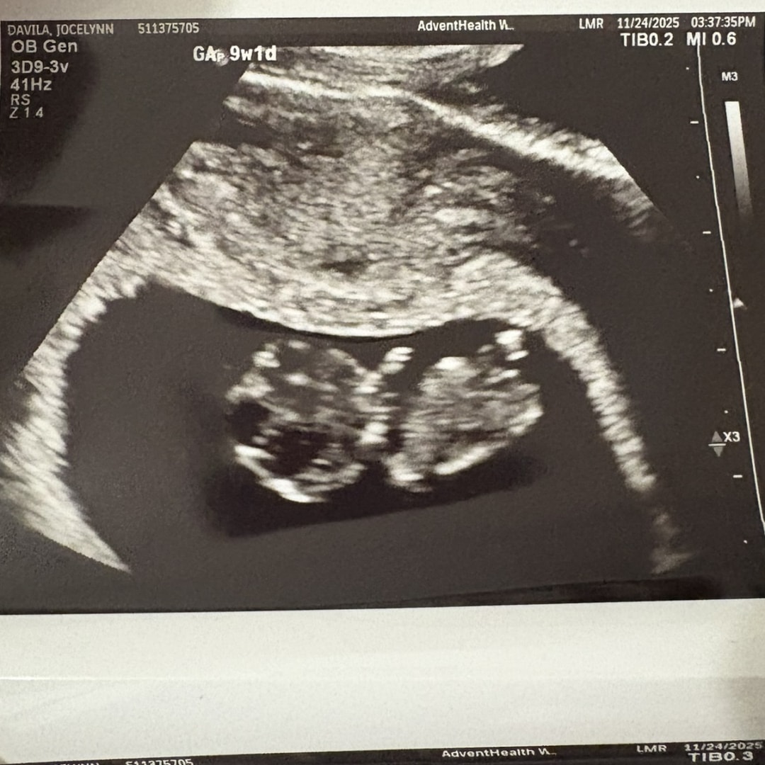 Photo shared by Jocelynn for their Babylist baby registry.