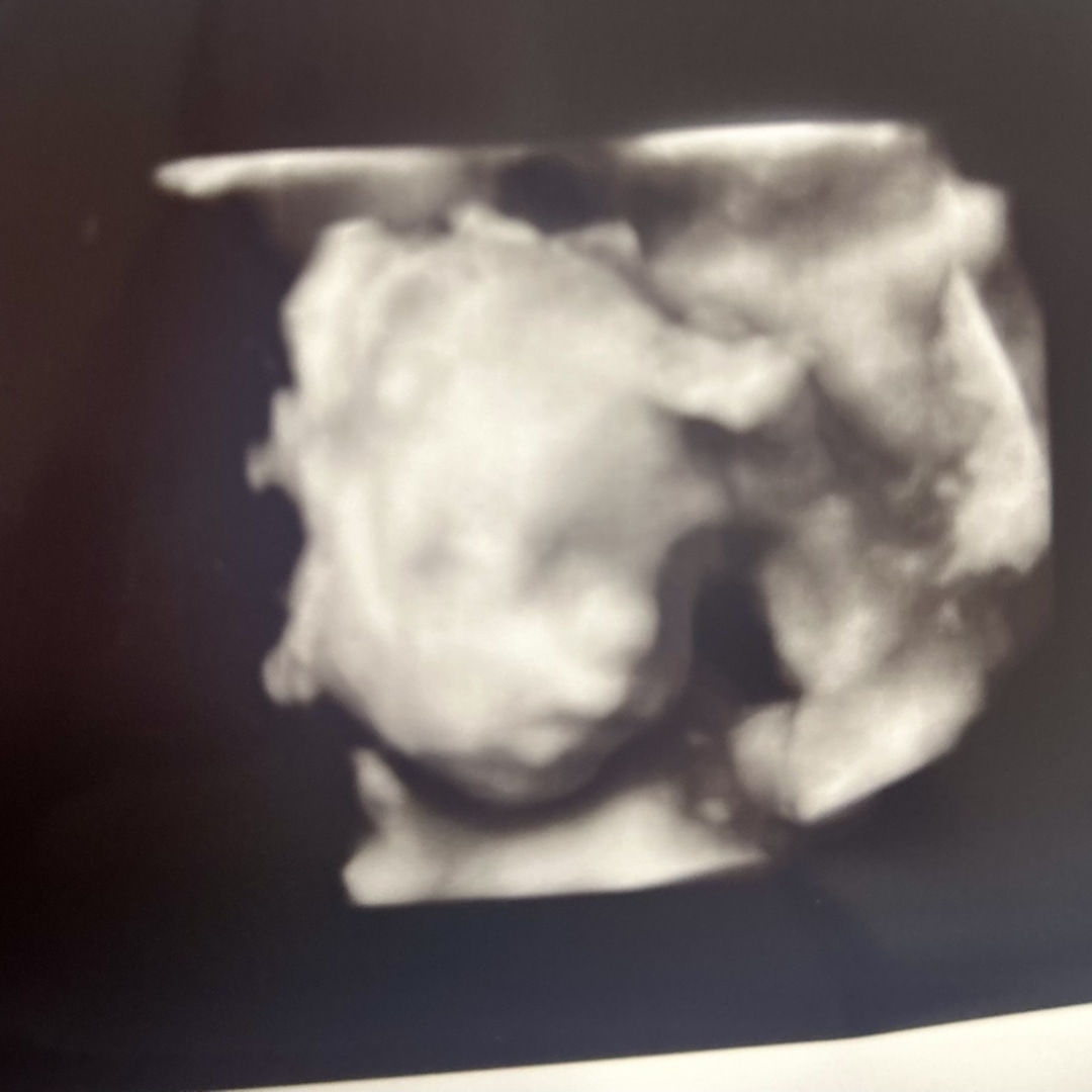 Photo shared by Jennifer for their Babylist baby registry.