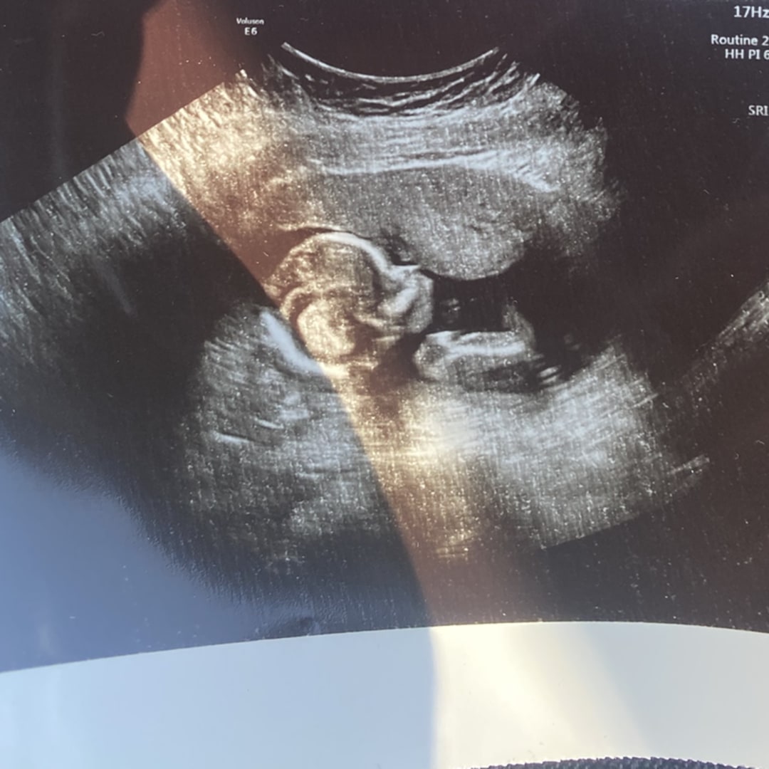 Photo shared by Alexea for their Babylist baby registry.