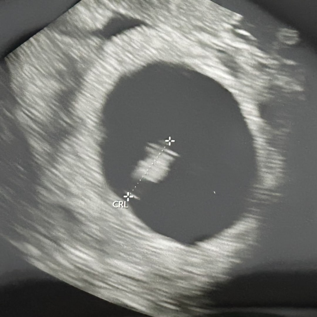 Photo shared by Angela for their Babylist baby registry.