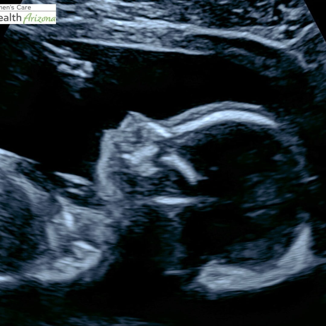 Photo shared by Bree for their Babylist baby registry.