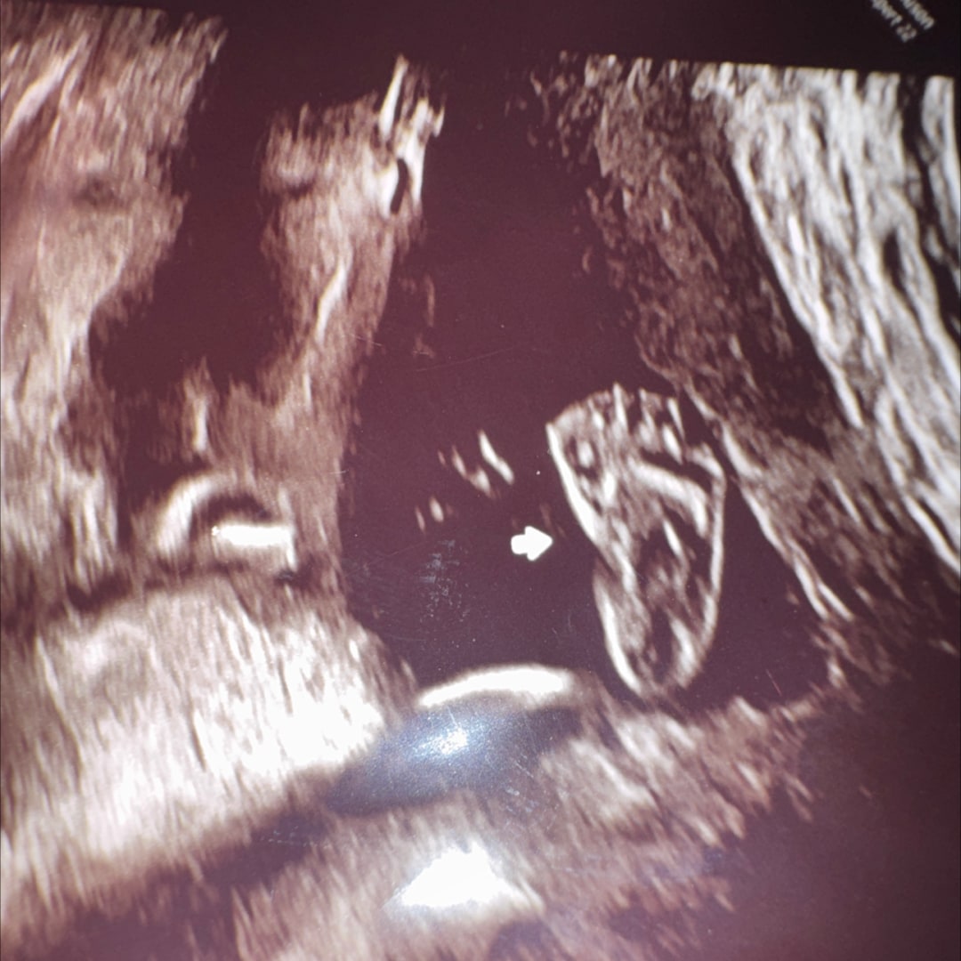 Photo shared by ESTEFANI for their Babylist baby registry.