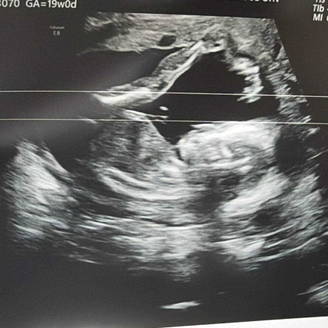 Photo shared by Dora for their Babylist baby registry.