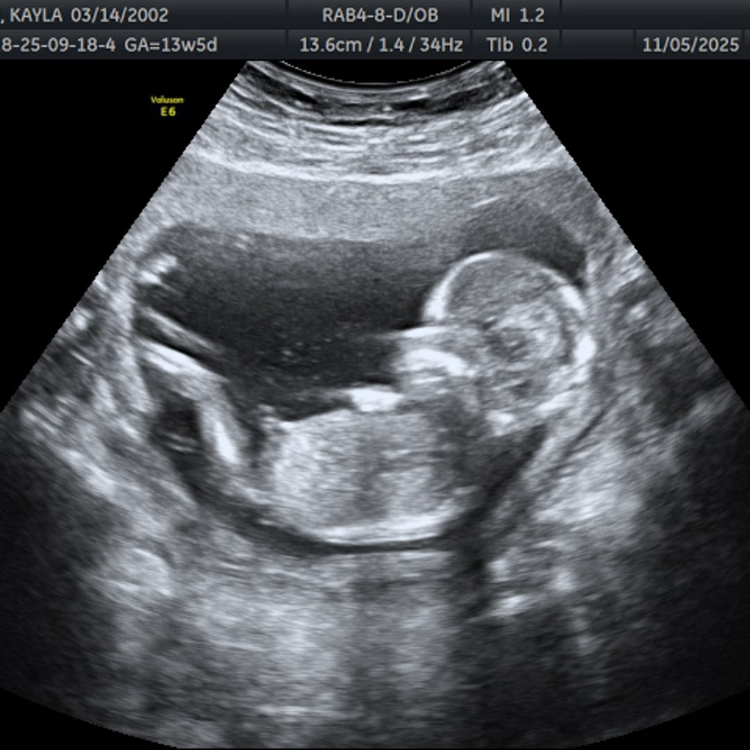 Photo shared by Satya for their Babylist baby registry.