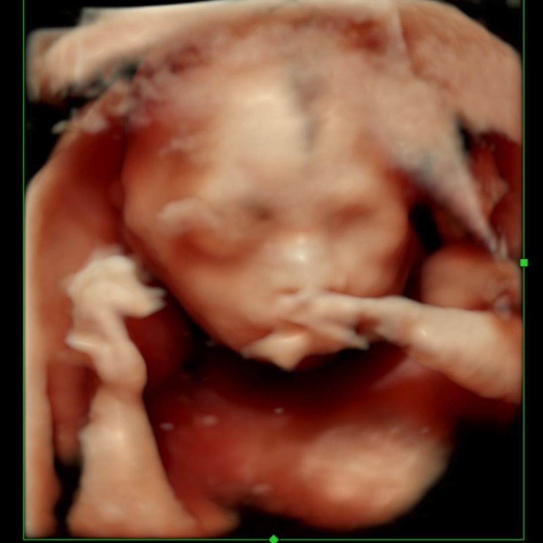 Photo shared by Narelle for their Babylist baby registry.