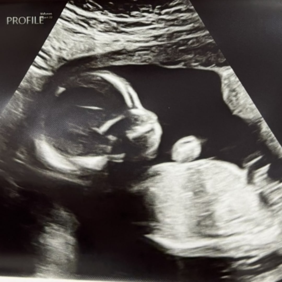Photo shared by Victoria for their Babylist baby registry.