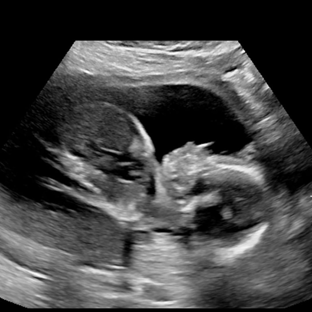 Photo shared by Isabella for their Babylist baby registry.