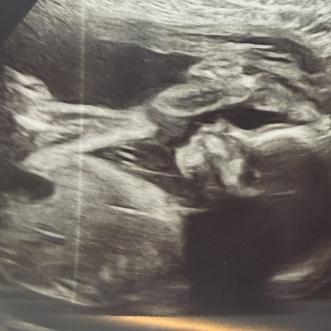Photo shared by Allison for their Babylist baby registry.