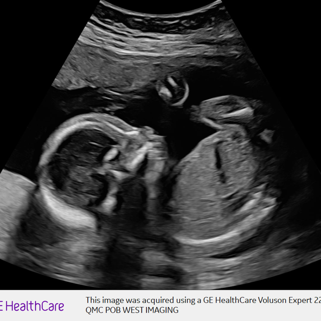 Photo shared by Solimar for their Babylist baby registry.