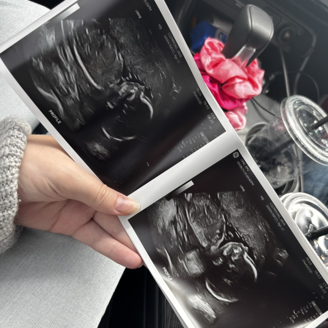 Photo shared by Jada for their Babylist baby registry.