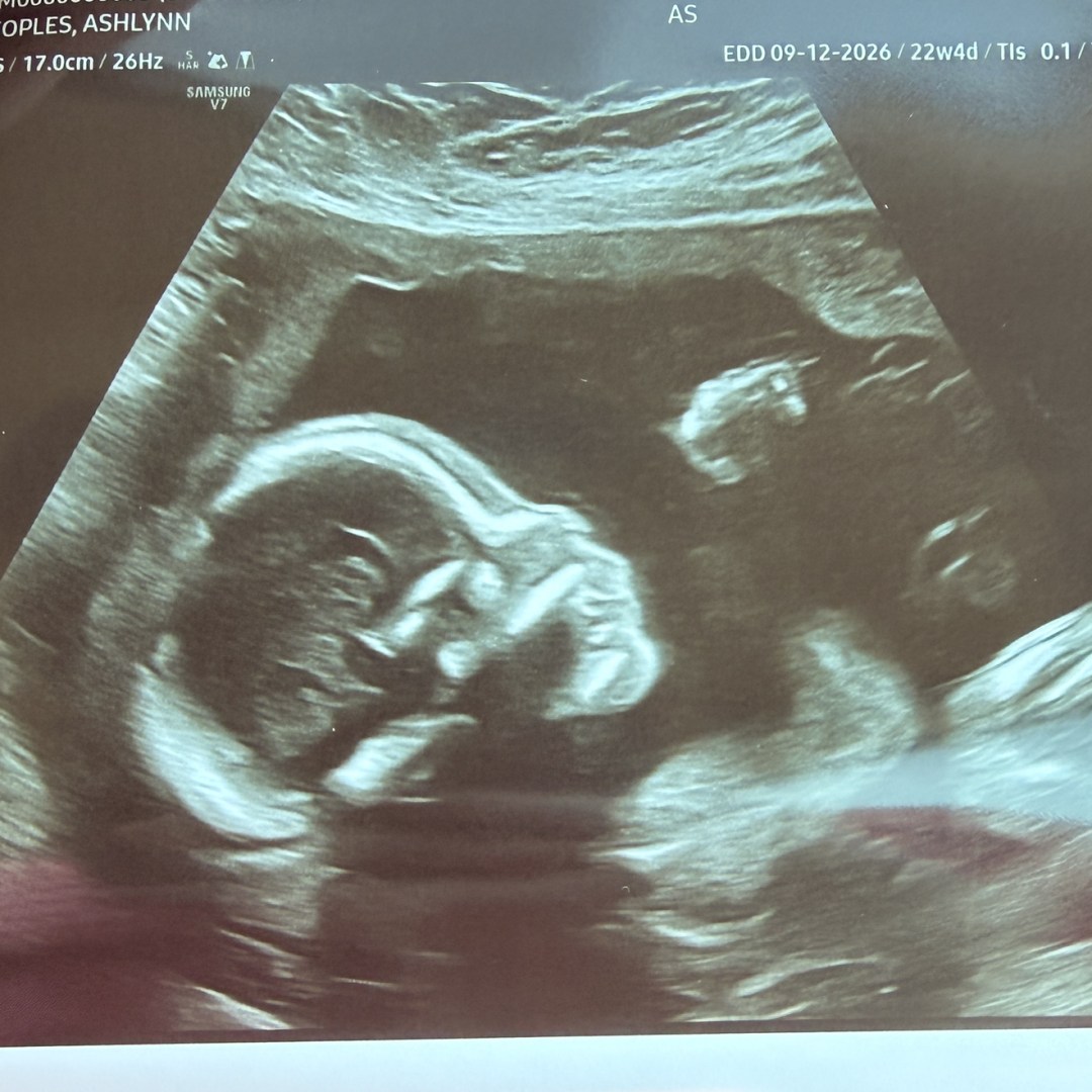 Photo shared by Ashlynn for their Babylist baby registry.