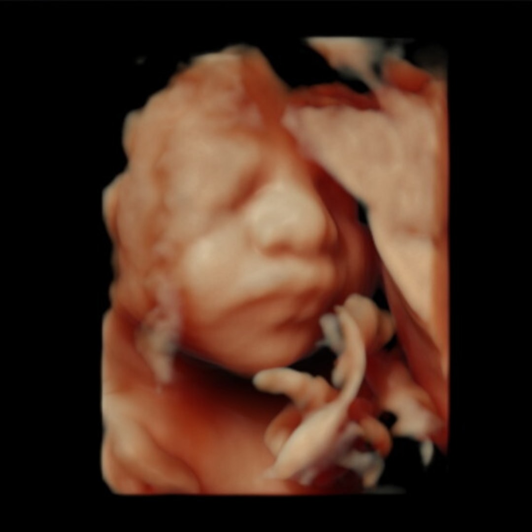 Photo shared by Amber for their Babylist baby registry.