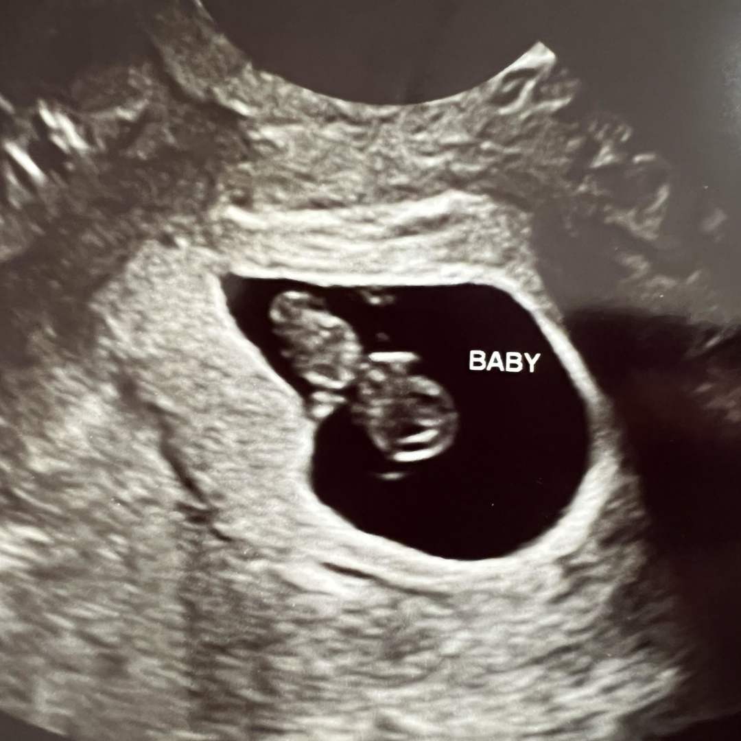 Photo shared by Ariel for their Babylist baby registry.