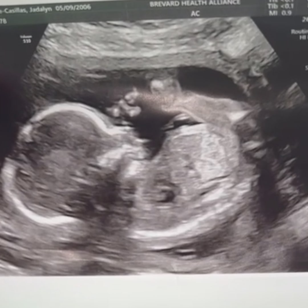 Photo shared by Jadalyn for their Babylist baby registry.