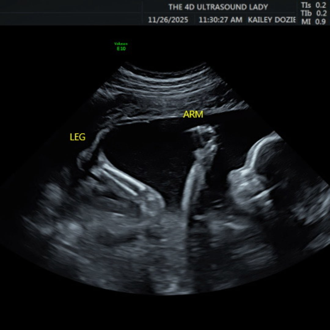 Photo shared by Champaine for their Babylist baby registry.