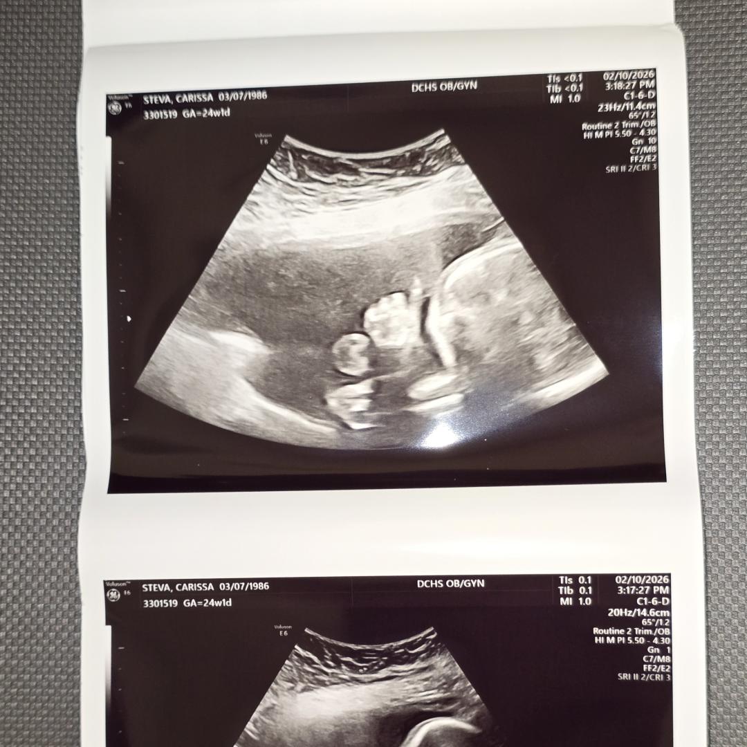 Photo shared by Carissa for their Babylist baby registry.