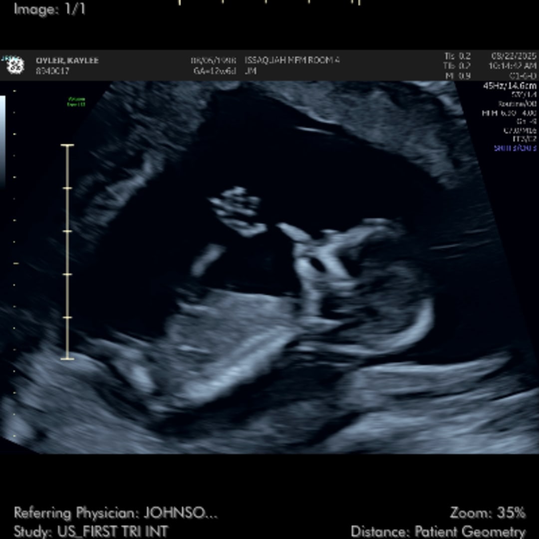 Photo shared by Kaylee for their Babylist baby registry.