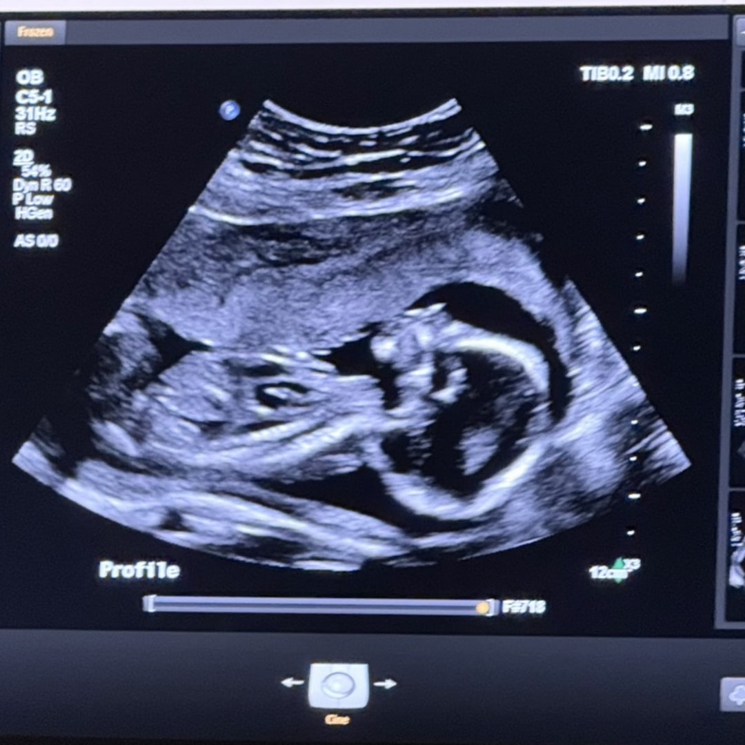 Photo shared by Jayme for their Babylist baby registry.