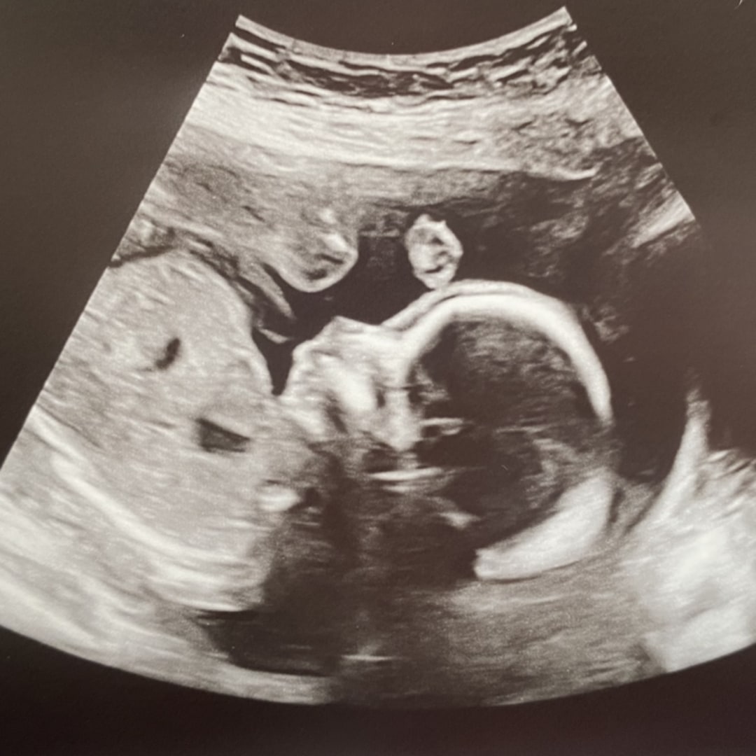 Photo shared by Amanda for their Babylist baby registry.