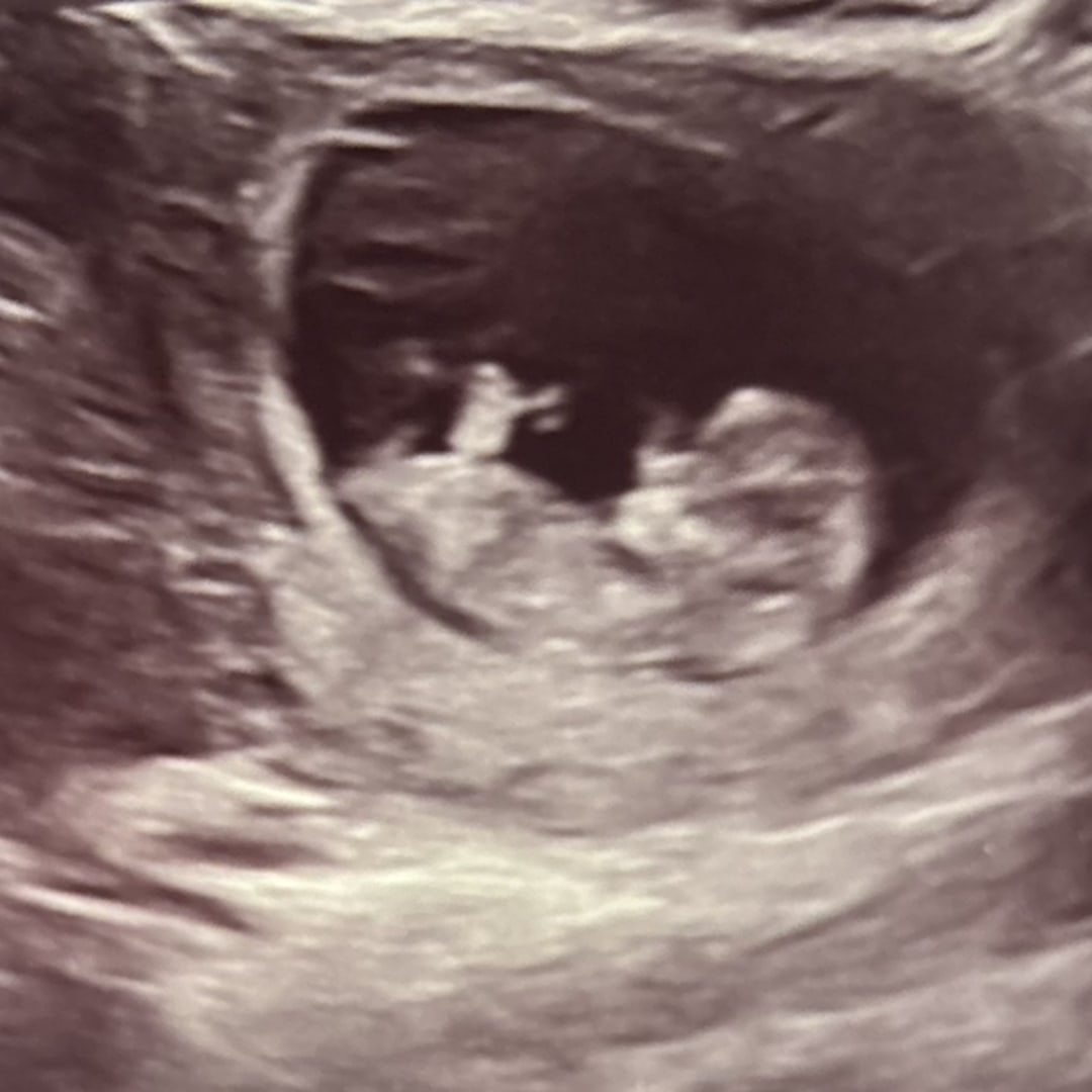 Photo shared by Mary for their Babylist baby registry.