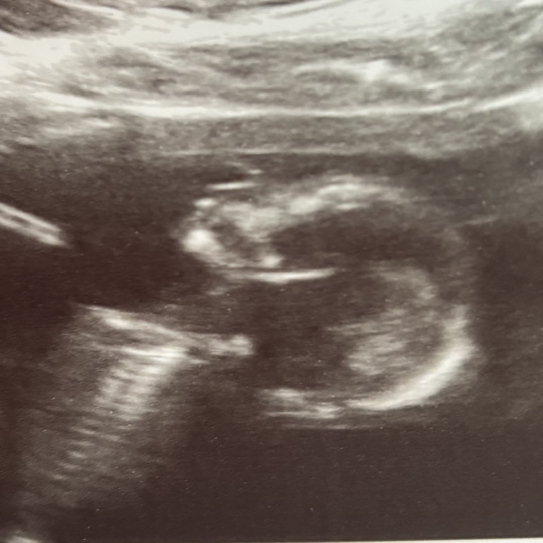 Photo shared by Katelyn for their Babylist baby registry.