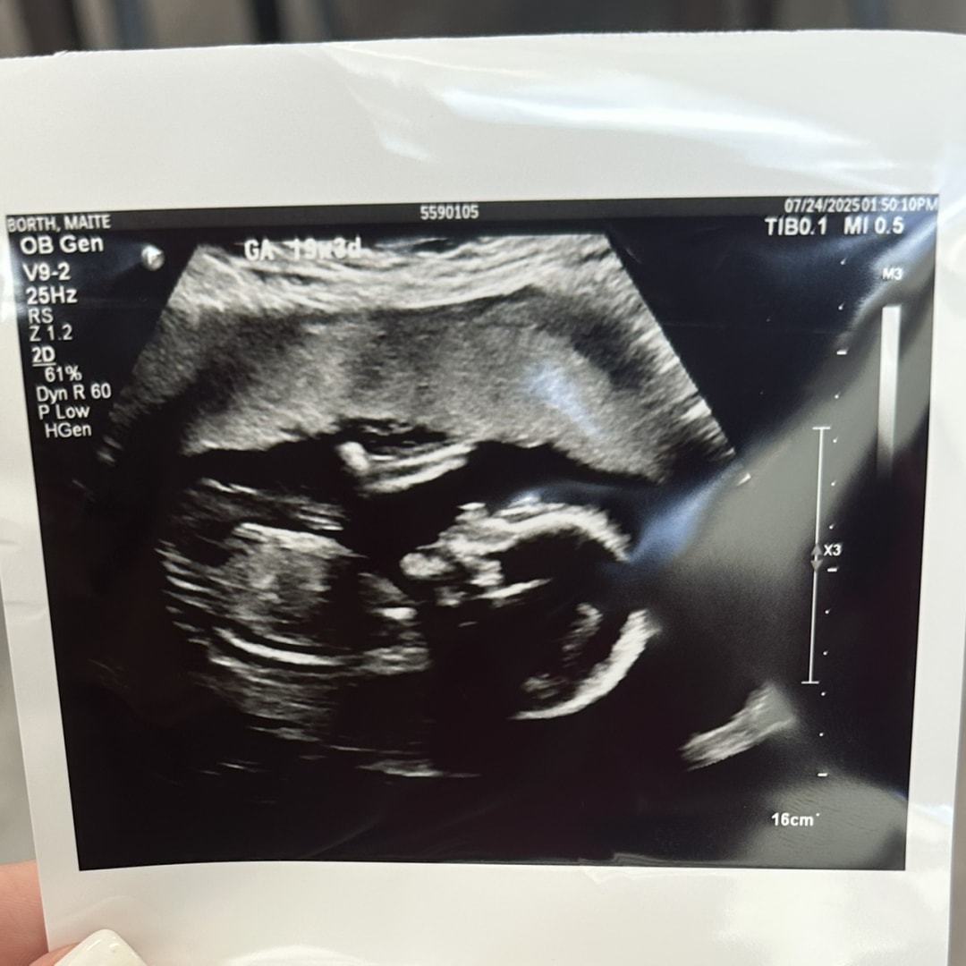 Photo shared by Maite for their Babylist baby registry.