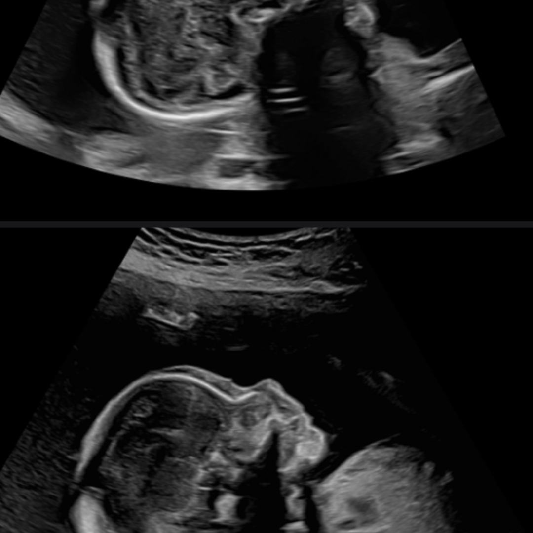 Photo shared by Makayla for their Babylist baby registry.