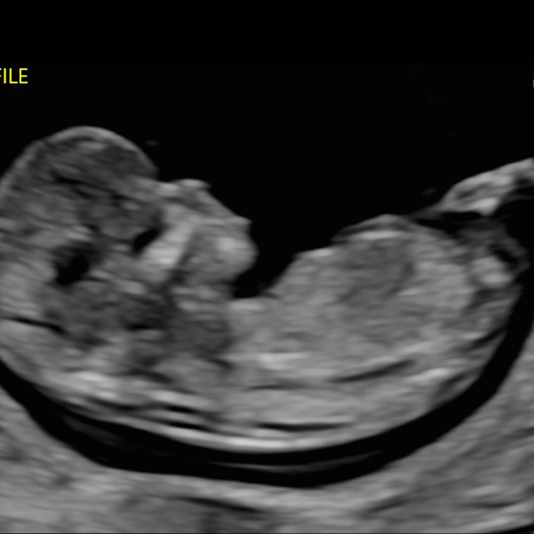 Photo shared by Claudia for their Babylist baby registry.