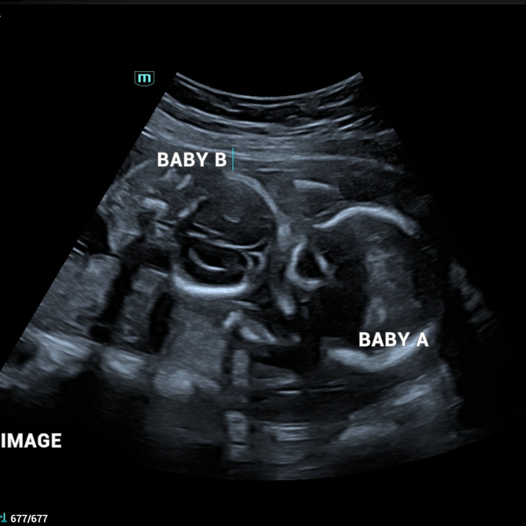 Photo shared by Starla for their Babylist baby registry.
