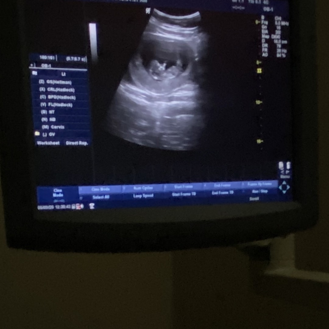 Photo shared by Anayha for their Babylist baby registry.