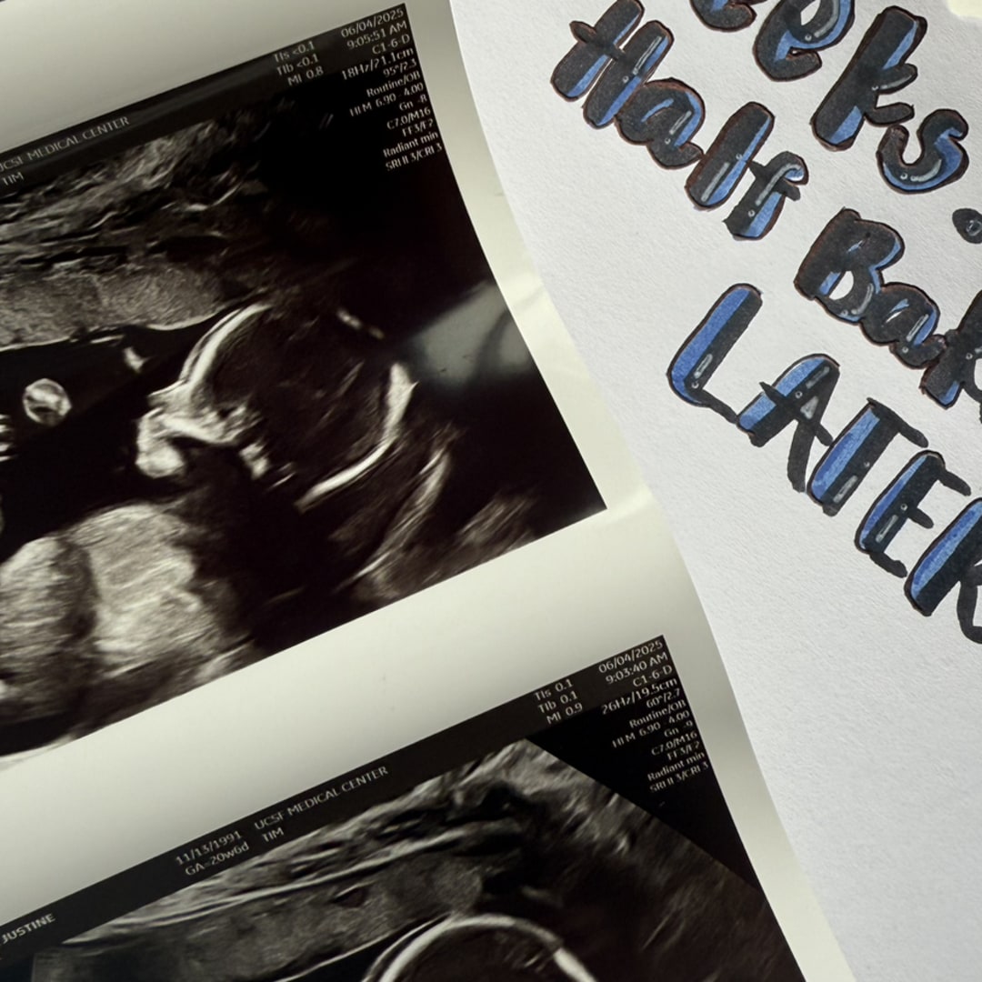 Photo shared by Justine & Jason for their Babylist baby registry.