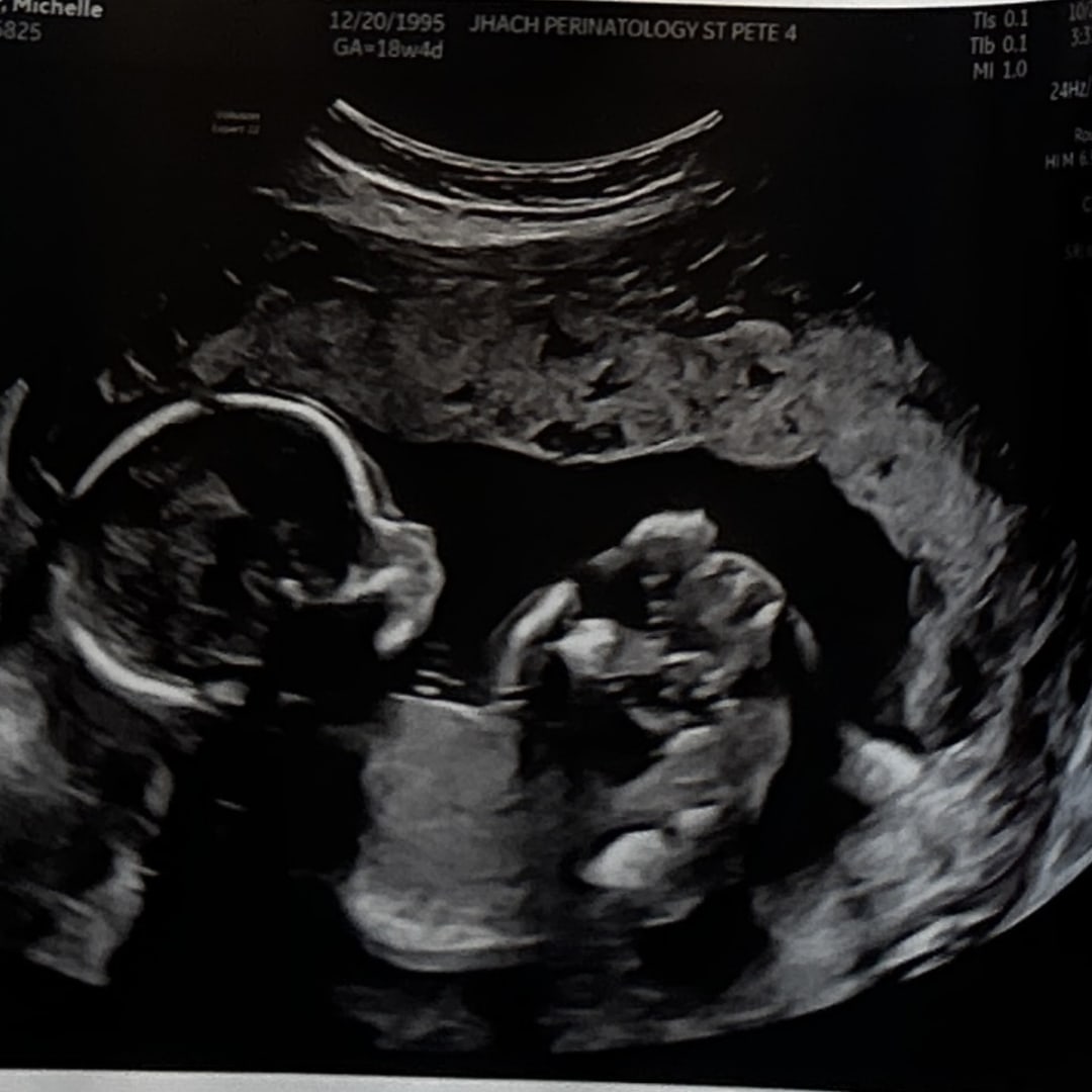 Photo shared by Michelle for their Babylist baby registry.
