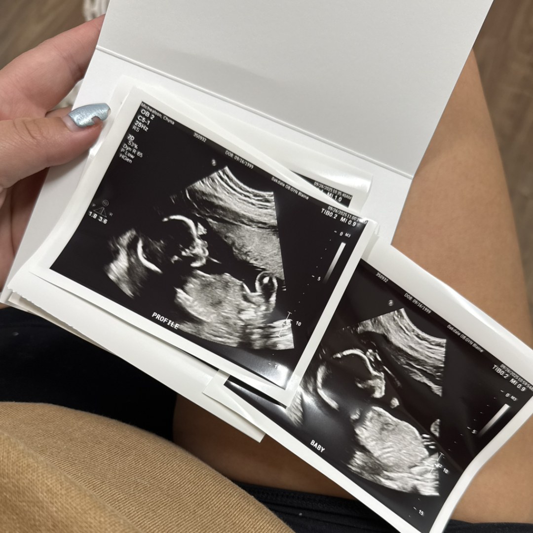 Photo shared by Chyna for their Babylist baby registry.