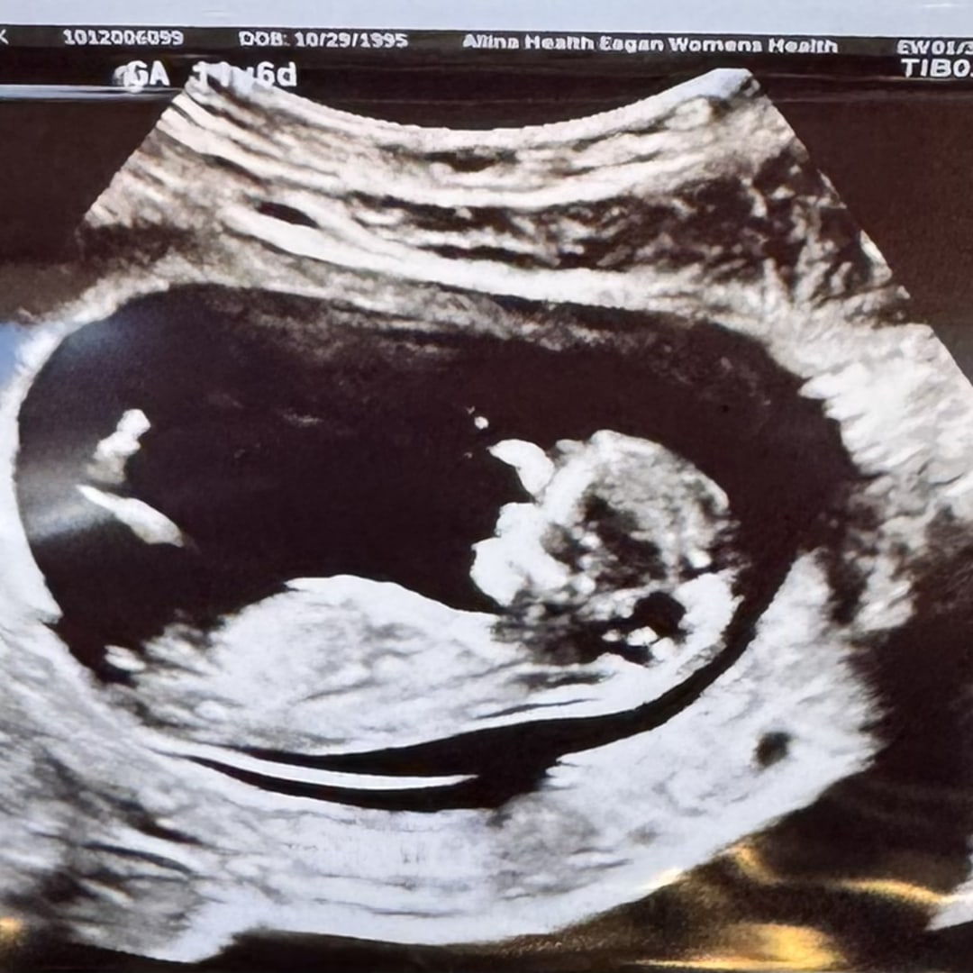 Photo shared by Jordyn for their Babylist baby registry.