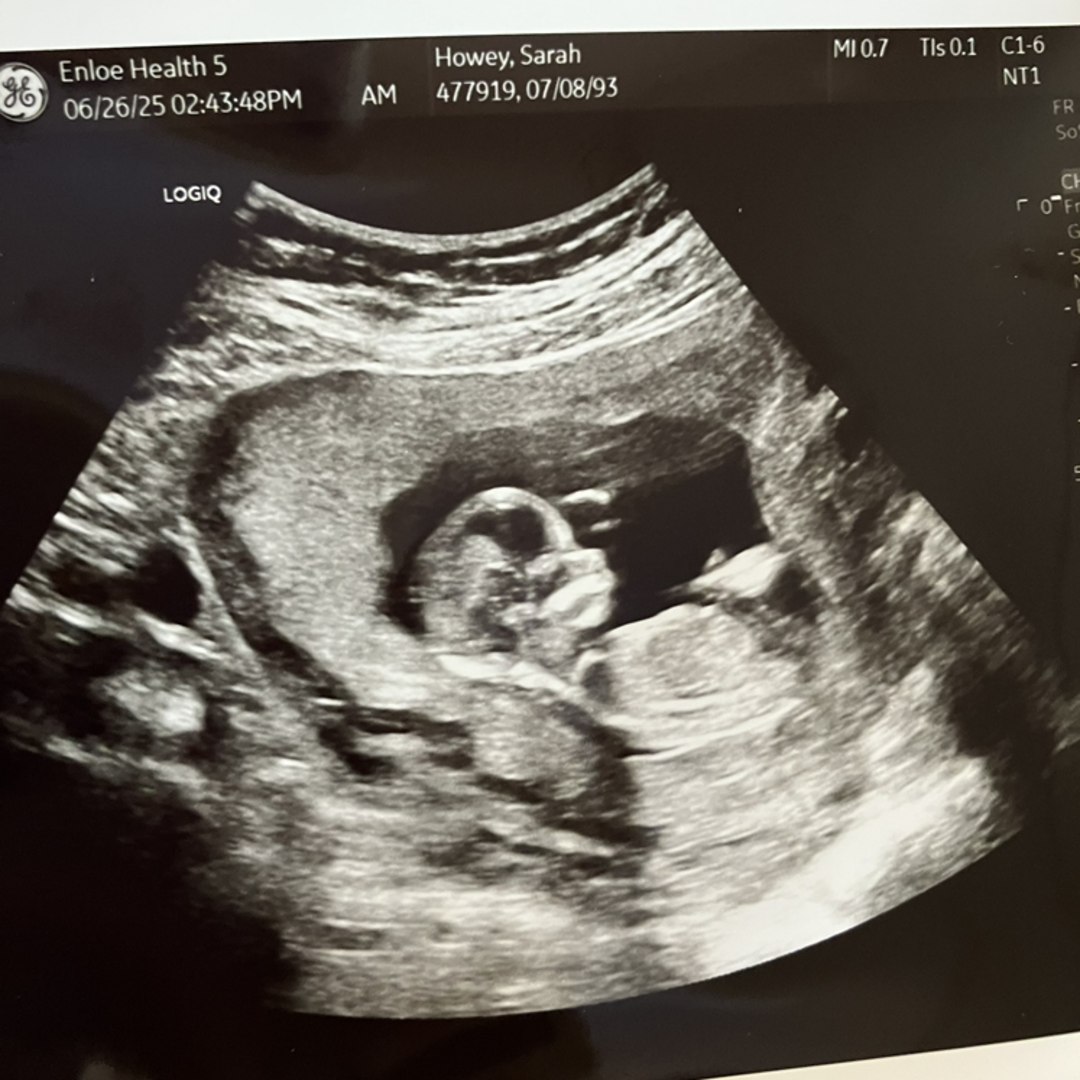 Photo shared by Sarah for their Babylist baby registry.